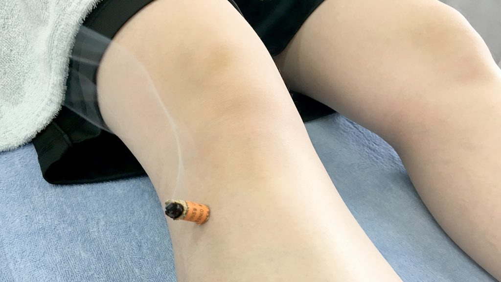 足三里のお灸