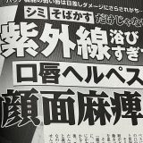 紫外線が原因の顔面神経麻痺