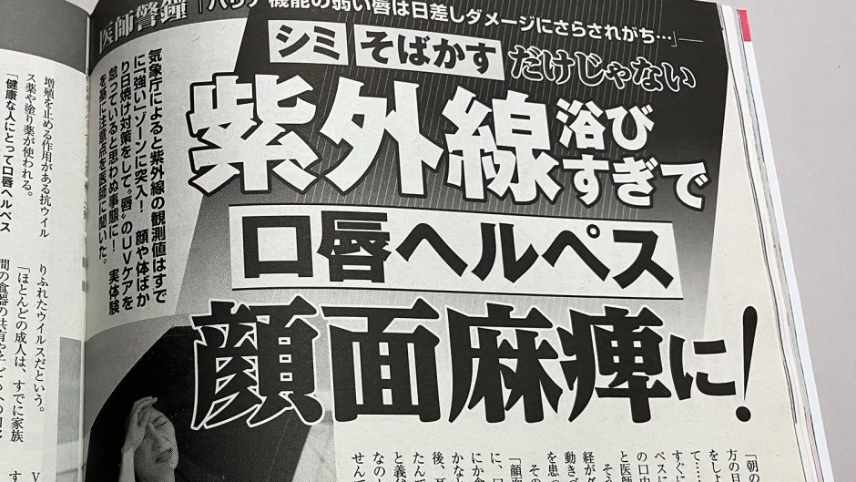 紫外線が原因の顔面神経麻痺