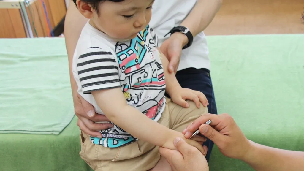 子どもの脱毛症
