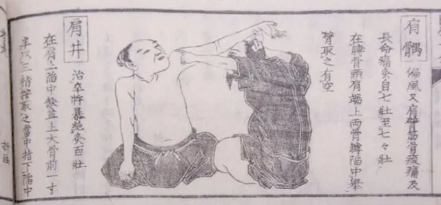 江戸時代から続く五十肩の治療