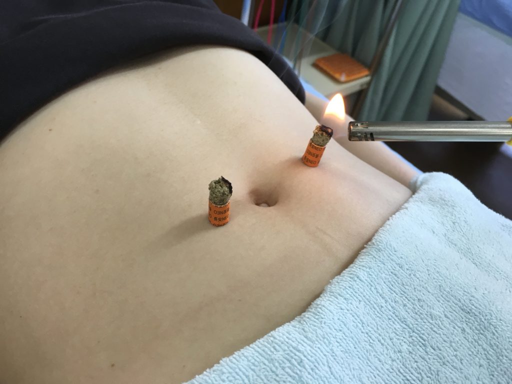 浜松市専門外来:過敏性腸症候群